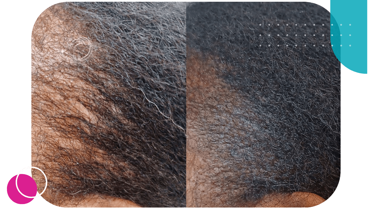 before and after microblading in Norristown Pa