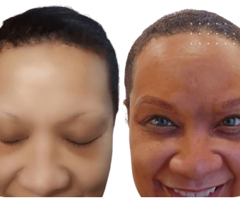 combo brows before and after