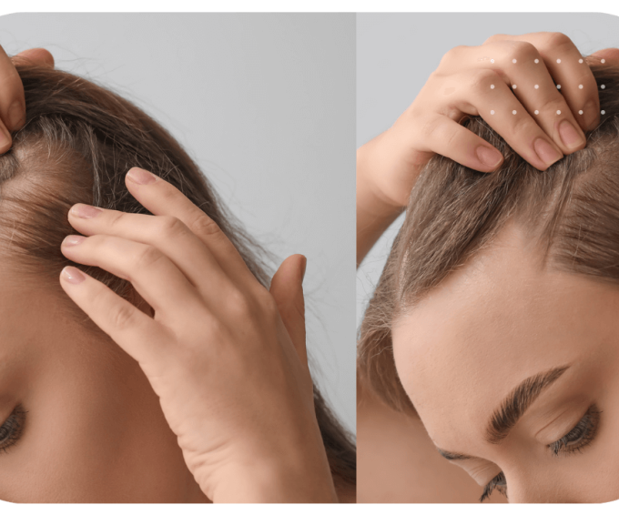 microblading hairline